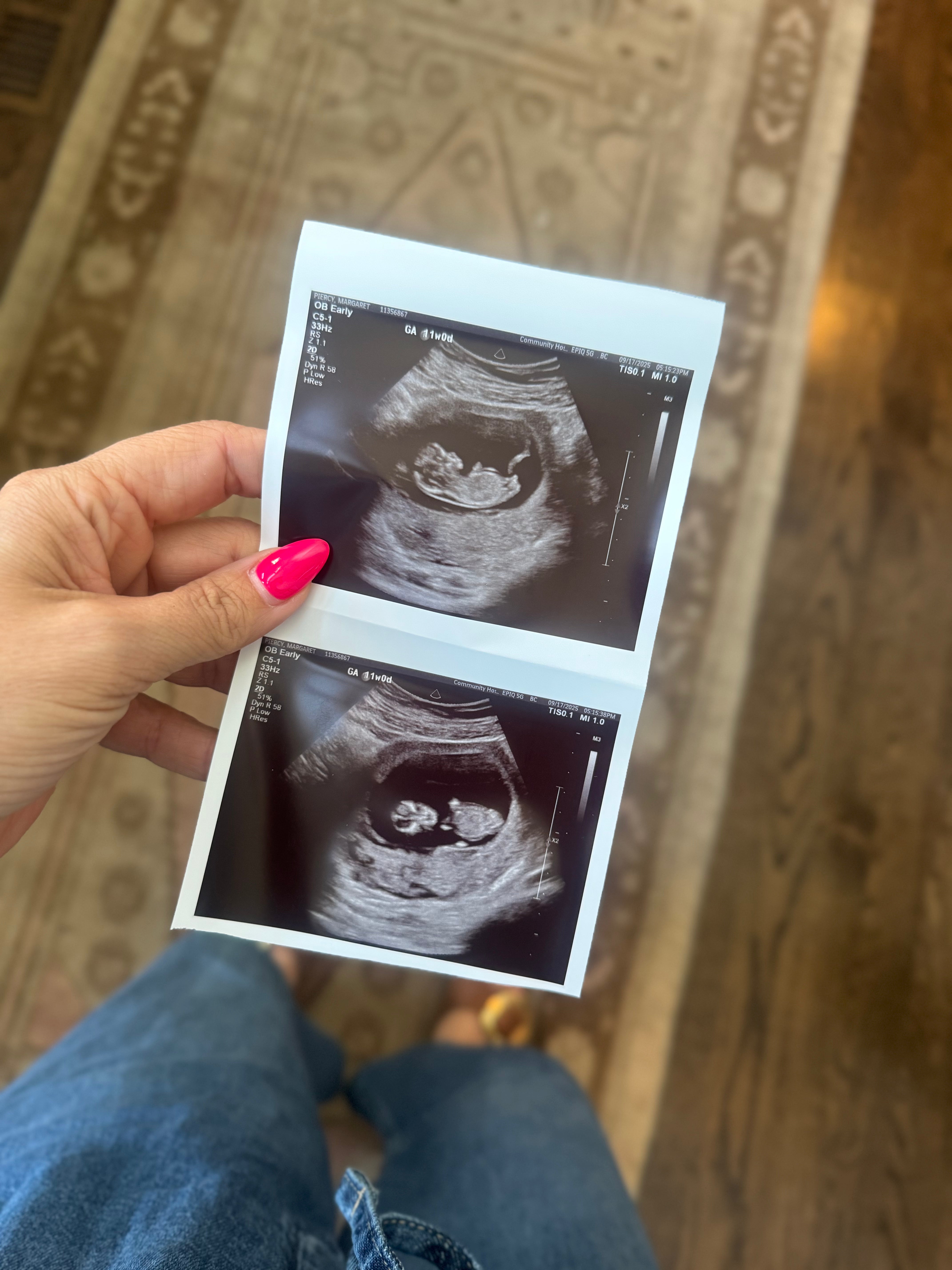 What No One Tells You About Being Pregnant at 41